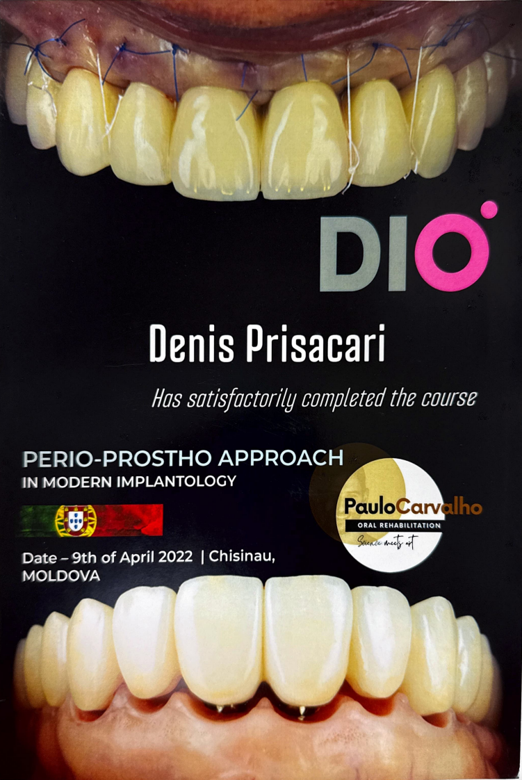 PERIO-PROSTHO APPROACH IN MODERN IMPLANTOLOGY