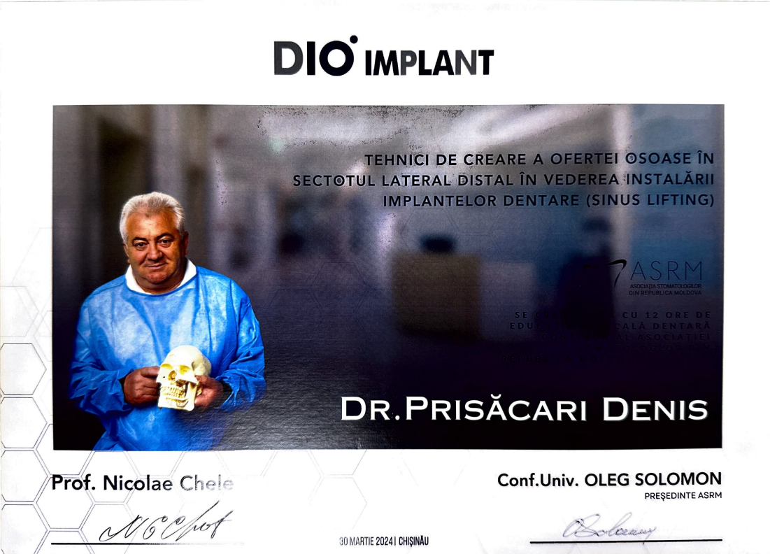 TEHNICI DE CREARE A OFERTEI OSOASE ÎN SECTOTUL LATERAL DISTAL ÎN VEDEREA INSTALĂRII IMPLANTELOR DENTARE (SINUS LIFTING)