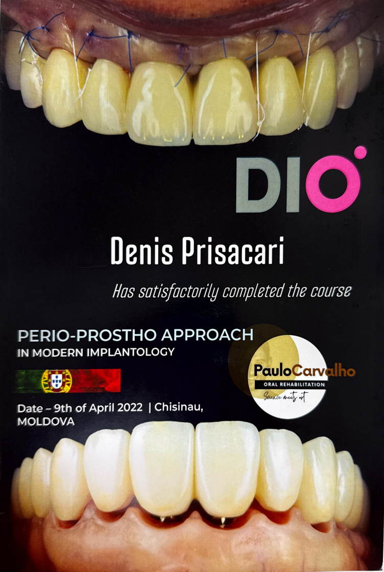 PERIO-PROSTHO Approach in Modern Implantology